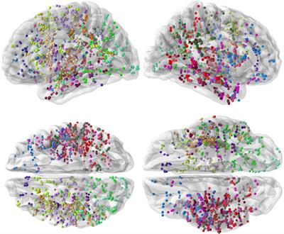 A comparison of uni- and multi-variate methods for identifying brain networks activated by cognitive tasks using intracranial EEG